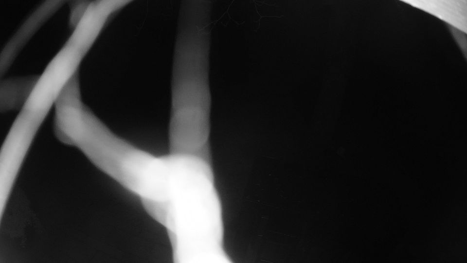 Habichtswald › South-west